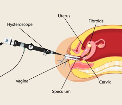 Pregnancy and high-risk maternity care