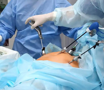 Hysteroscopy procedure at Noble Plus Hospital