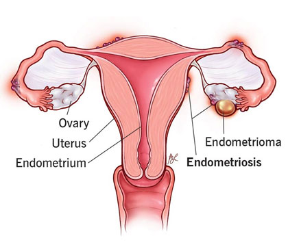 Infertility treatment and counseling